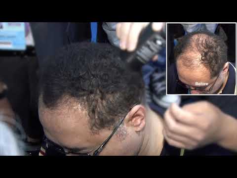 Caboki Hair Fiber - Thinning Hairline - CABOKI Reviews