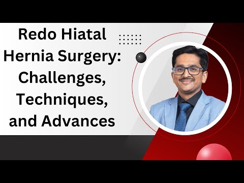 Redo Hiatal Hernia Surgery: Challenges, Techniques, and Advances - by Dr. Tarun Mittal at WALS 2025