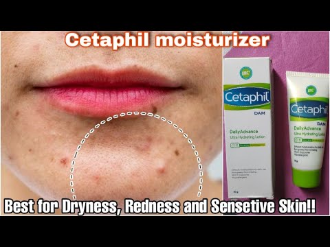 Cetaphil Moisturizing Cream Review | Best Moisturizer For Dry Skin | Cetaphil Ultra Hydrating Lotion