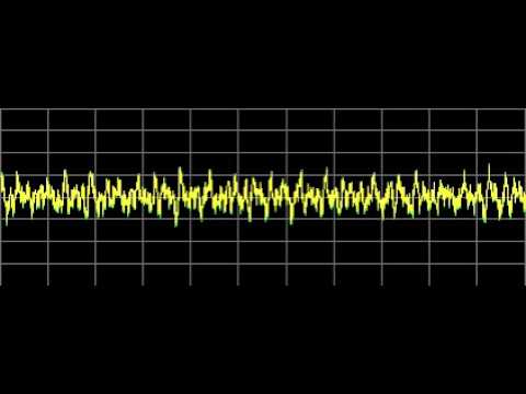 Lupus - Rife Frequencies