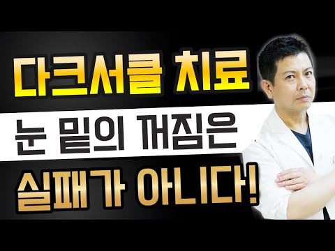 【다크서클치료】눈밑의꺼짐에대해철저히해설!움푹들어간건지나친제거때문이아니다！