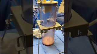 What Getting a BBL Surgery is REALLY Like! Gender Affirming Brazilian Butt Lift #bbl #plasticsurgery