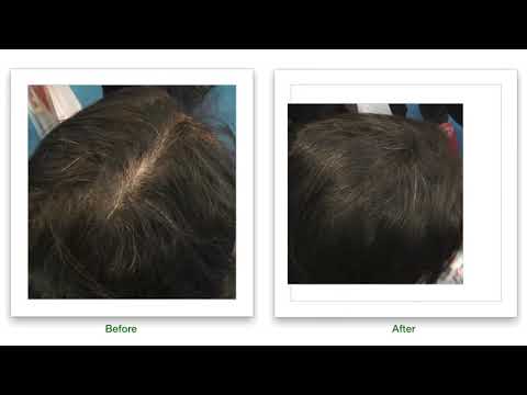Caboki Hair Fiber - Does Caboki work for women? - Caboki For Women