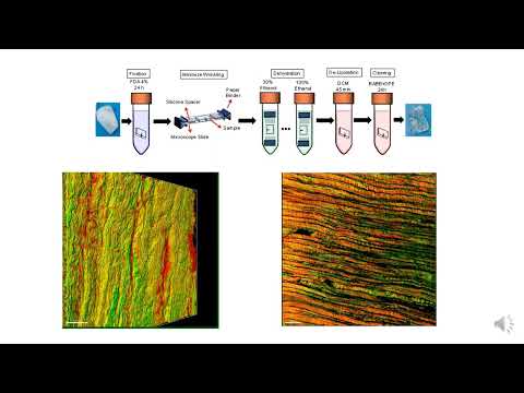 Deep tissue imaging of annulus fibrosus using uDISCO clearing and two photon microscopy
