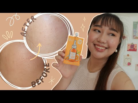 The Secret To Skin Brightening (ft. Hello Glow) | Ayessa Munich