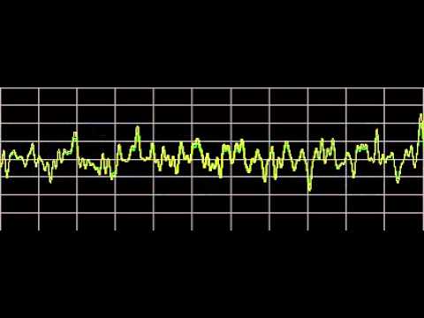 Cluster Headaches - Rife Frequencies