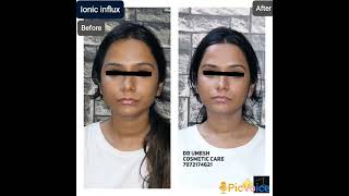 #detanfacial#face #skincare #skinwhitening skin #galvanic #medifacial #detanning