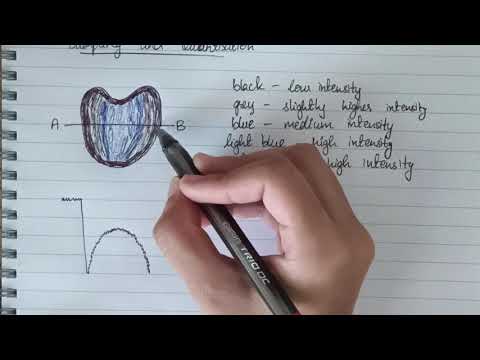 Sampling and Quantization in Digital Image Processing