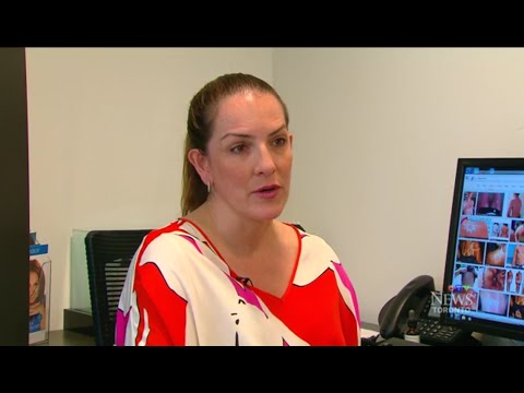Dr. Carroll Discusses the Dangers of Sunburn Art