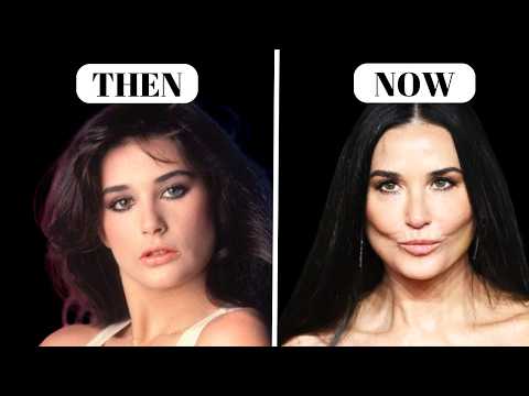 Demi Moore's NEW LOOK | Plastic Surgeon Reacts