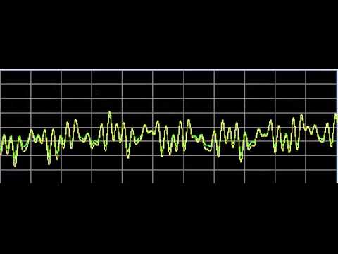 Autism (Autistic Disorders)-Rife Frequencies