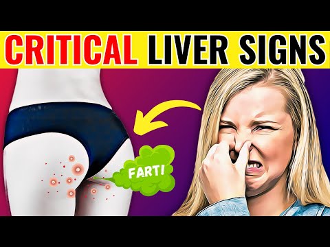 8 STRANGE Signs Your Liver Is DYING! DANGEROUS!