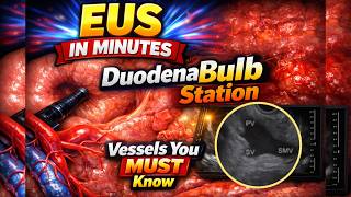 Learn EUS FAST: Duodenal Bulb Vessels Made Simple