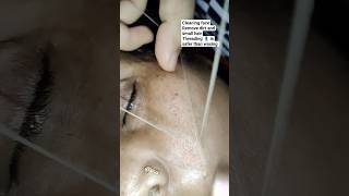 #threading #dirt #removal #hairremoval #faceclean #face #threadingwork #skincare #care #shorts