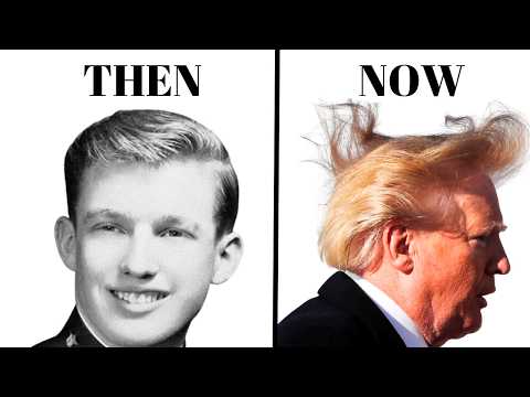 Donald Trump's Hair Transplant | Hair Surgeon Reacts