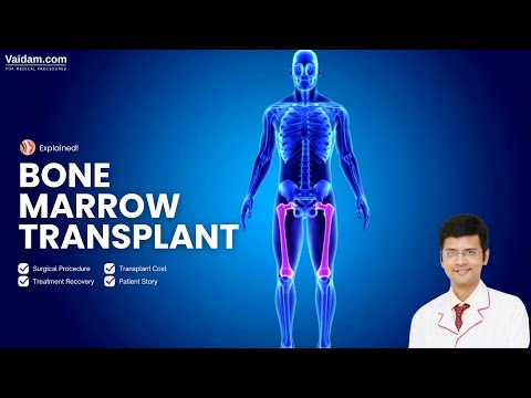 Bone Marrow Transplant in India: Procedure, Cost & Recovery and Best Hospitals