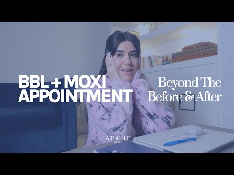 Elmira’s BBL & MOXI Journey | Beyond the Before & After Ep. 4