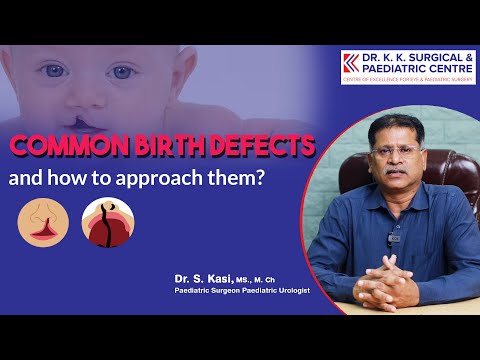 Common Birth defects and how to approach them - Dr Kasi (Tamil)