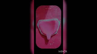 Custom tray / Special tray || prosthodontics #BDS  || #bdsshorts