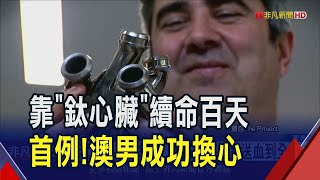 真人版鋼鐵人 澳男移植"鈦心臟"續命迎新生 器官移植新篇章 鈦心臟終極目標換心不用等｜非凡財經新聞｜20250313