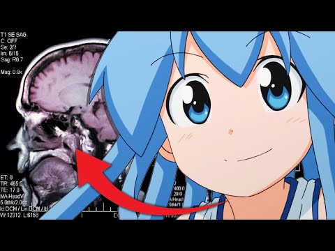 What Actually IS Squid Girl?