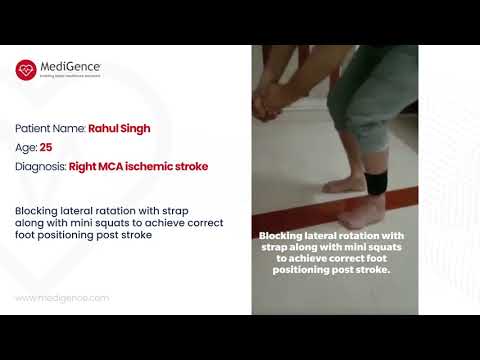 Rahul Singh - Correcting Foot Positioning After Right MCA Ischemic Stroke