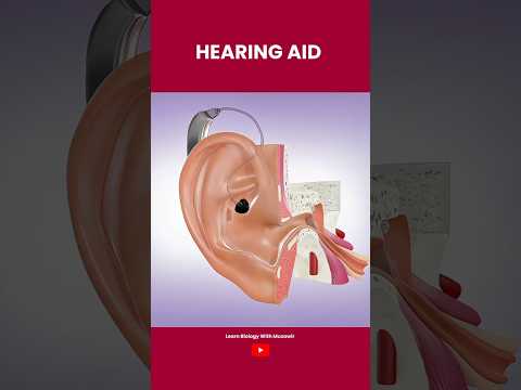 Hearing aid | Hearing loss treatment