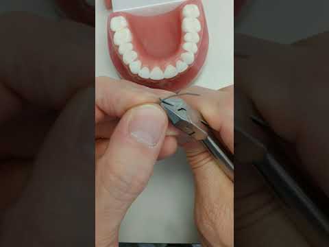 Upper fixed retainer technique