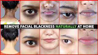 Remove FACIAL BLACKNESS NATURALLY At Home | DARK CIRCLES, MOUTH BLACKNESS, DARK LIPS + More |