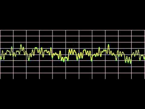 Halitosis (Bad Breath) - Rife Frequencies