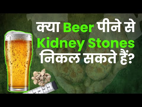 Does Drinking Beer Help in Passing Kidney Stones? | क्या बीयर पीने से किडनी स्टोन निकल सकते हैं?