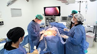 Dr. Jesus Ceja Performs Gastric Sleeve Surgery in Tijuana, Mexico