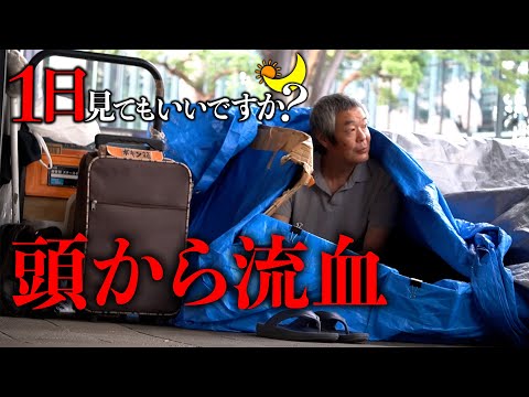 【1日見てもいいですか？】新宿の路上で暮らすホームレス〜頭から流血するほどの虐待を受けた過去〜