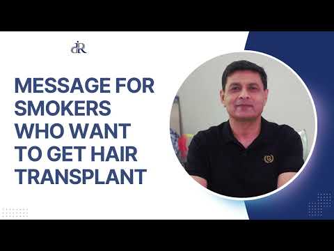 Can Smokers have a Hair Transplant Surgery ? | Hair Transplant Results of Smokers | Dr Rana Irfan