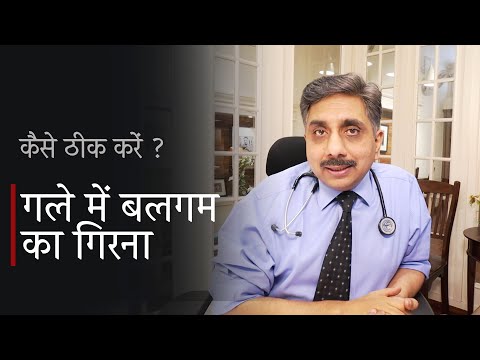 गले में बलगम का गिरना कैसे ठीक करें ? Post Nasal Drip Treatment With Natural Homeopathic Medicines