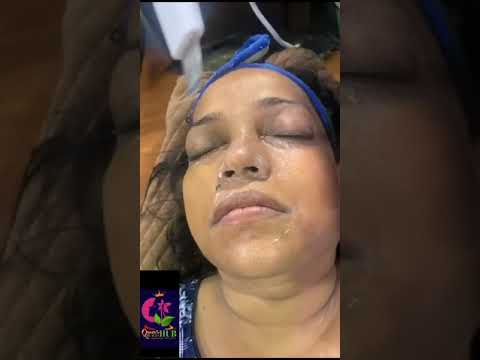Hydra facial#Shyampur#Bhubaneswar