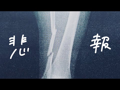 86話【超悲報】※骨折画像注意 腓骨に大問題発生！病院から究極の選択を迫られる【入院生活VLOG】