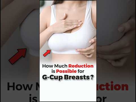 How much Reduction is Possible for G Cup Breast? #faqs