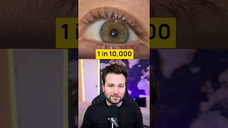 How Rare Is Your Body? - PART 1