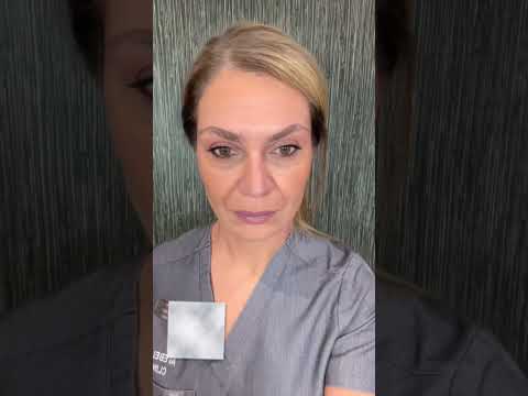This clinic claims this transformation is done by only injections! #scamalert #torontoblogger