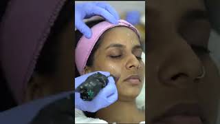 Detan Treatment | Depigmentation | SkinGlow Treatment | Most Effective Sun Tan Removal |Dr.Divyanair