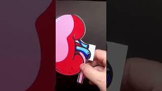 #kidney #kidneycancer #kidneytumor #surgery #funnycard #cardmaker #ptsd #creativityheals