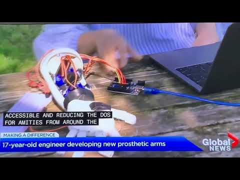 Global News Vision Arm Feature