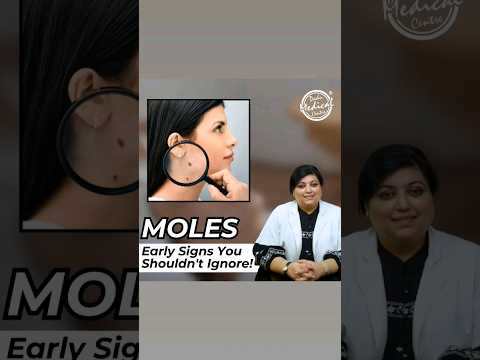 STOP Ignoring These MOLE Symptoms! #moles #shorts #drniveditadadu #youtube