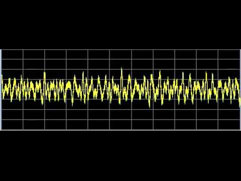 Lyme Disease - Rife Frequencies