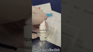 Dengue combo Test.//Sannanmedicallab || #laboratory #fact #medicallabtechnologist #laboratory