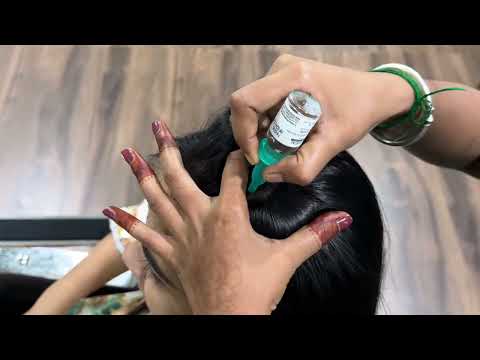 “अब डैंड्रफ नहीं रहेगा | Best Dandruff Soluton