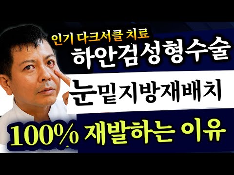 【충격】하안검수술・눈밑지방재배치가 “확실히 재발”하는 이유 【눈밑 처짐】화제의 영상