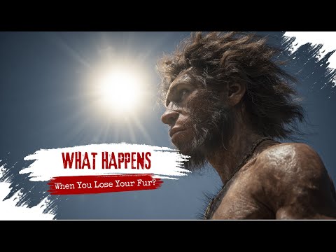 What REALLY Happens When You Lose Your Fur Forever?