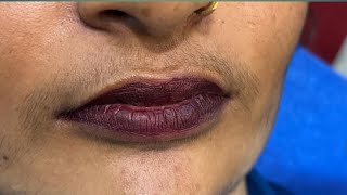 Upper lips waxing by Rica Brazilian wax / #waxing #upper lipswaxing#waxingtips #ricawax #beauty #wax